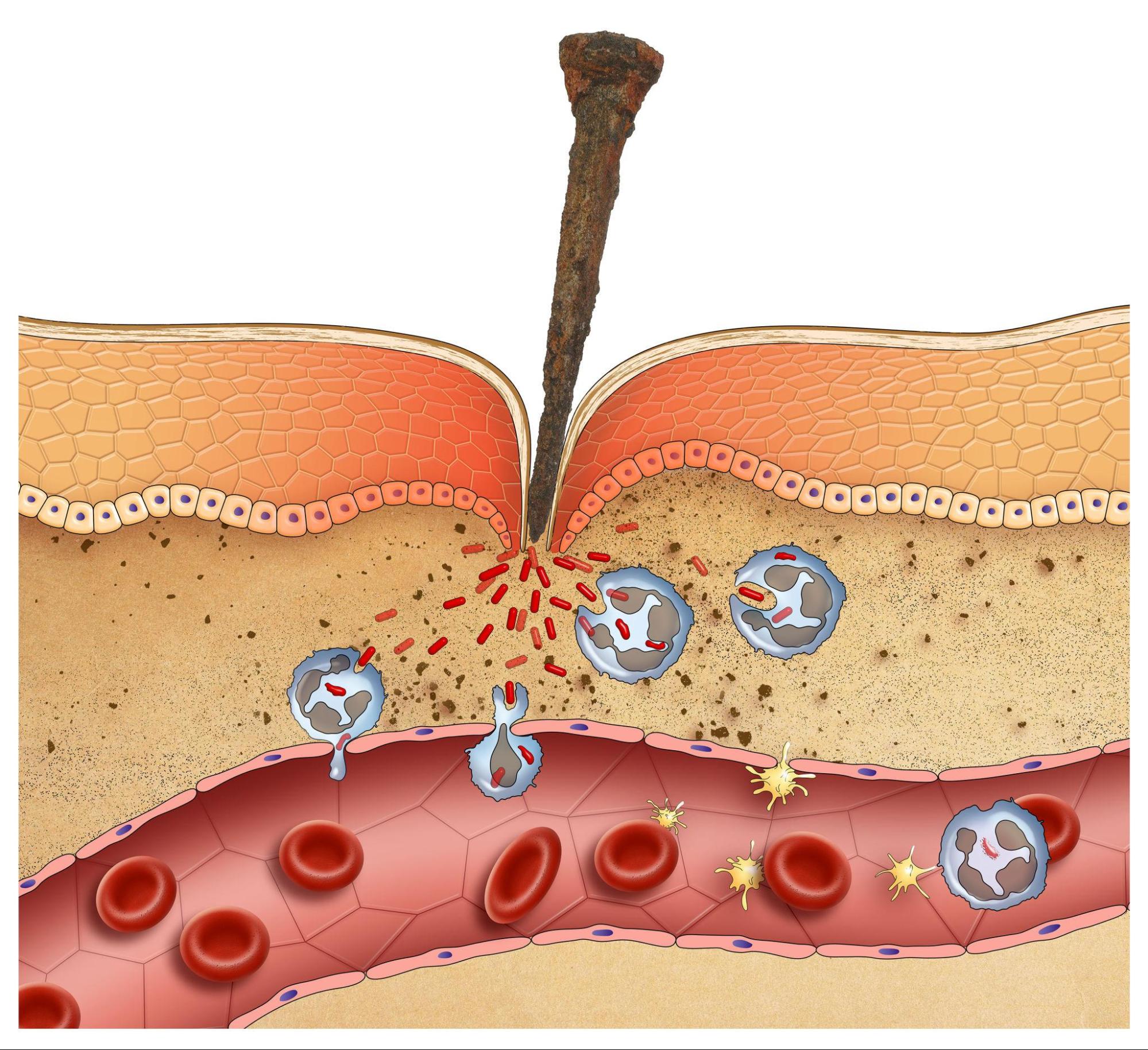what is inflammation